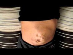 a man's stomach is shown with the bottom part of his body showing it's scar