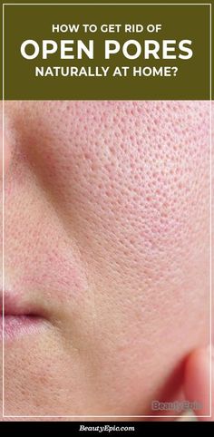 How To Get Rid of Open Pores Naturally at Home? Minimize Pores Naturally, Big Pores, Face Pores, Beauty Hacks Skincare, Open Pores, Smaller Pores, Natural Face Skin Care, Make Up Videos, How To Get Rid Of Pimples