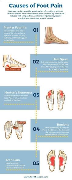 Foot Pain Chart, Pain Chart, Natural Headache, Morton's Neuroma, Skin Bumps, Natural Therapy, Heel Pain, Foot Health, Foot Pain