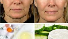 Saggy Face Skin, Saggy Face, Sagging Face, Facial Care, Face Care, Face Skin, Facial Skin, Beautiful Skin, Beauty Secrets