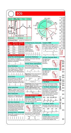 Cardiac Meds, Paramedic Cardiology, Cardiac Catherization Nursing, Ecg Lead Placement, Nurse Teaching, Ecg Interpretation, Nursing Schools