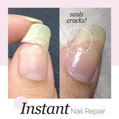 No more painful Cracked & Broken nails! Instant Nail Repair Gel can instantly repair¬†and fill in any cracks while adding a nice shine and finish to it!It also binds and protects the cracked spot to hasten nail repair. Intact nails also mean zero bacterial infection at the nail beds.Simply brush over the damaged area and let it dry. It‚Äôs quick drying and won‚Äôt interfere with nail polish color. Feel free to style your perfect, healthy nails! FEATURES: Instant Nail Repair Natural Finish Streng Repair Broken Nail, Split Nails, Cracked Nails, Instant Nails, Broken Nails, Nail Repair, Damaged Nails, Brittle Nails