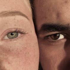 two people with freckles on their faces looking at the camera