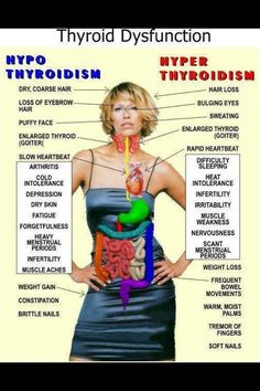 Thyroid Dysfunction Posted on November 6, 2012 by PositiveMed Team It’s really not uncommon for your thyroid to function incorrectly, and it’s usually an easy fix. This poster shows symptoms of both overactive and underactive, if you have symptoms of either one please consult your health care professional. Autoimmune Disease, Young Living Essential Oils, Health Remedies, Ayurveda