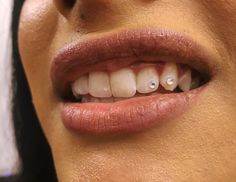 Invisalign Gems, Tooth Gems Simple, Simple Tooth Gems, Colored French Nails, Pretty Teeth, Dental Jewelry, Cinnamon Hair, Studera Motivation, Diamond Teeth