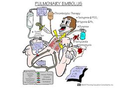 an image of a cartoon character with the words, fulmiary embolus