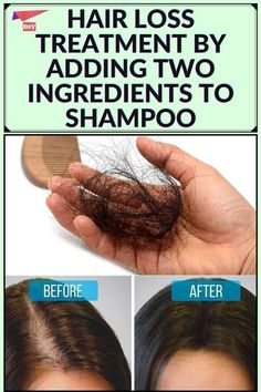 Hair Growth Tonic, Healthy Natural Hair Growth, Hair Growing Tips, Hair Remedies For Growth, Home Remedies For Hair, New Hair Growth, Healthy Natural Hair, Hair Control, Hair Help