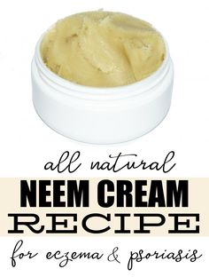 Not only is this homemade neem cream recipe easy to make, it's perfect for anyone suffering from just about any skin condition. While it works wonders as a natural remedy for eczema and psoriasis to help promote healing and offer relief, it can also be used to fight cold sores, athletes foot, acne and even scabies! Problem Skin, Cold Sores, Ginger Smoothie, Athletes Foot, Dr Oz, Natural Remedy