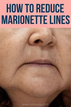 Lines Around Mouth, Marionette Lines, Face Yoga Exercises, Face Exercises