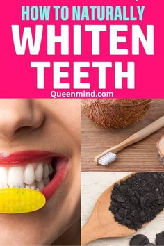 We can Whiten all types of Dental Care - Teeth Whitening - Caps & Crowns Naturally Whiten Teeth, Baby Bottle Tooth Decay, Cosmetic Dentistry Procedures