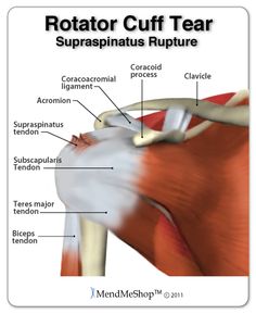 K Tape, Rotator Cuff Injury