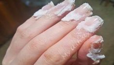 Baking Soda Nails, Get Rid Of Cold, Great Nails, Nail Fungus, Sodium Bicarbonate, Peppermint Essential Oil, Oral Hygiene, Change Your Life, Baking Soda