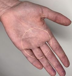 a person's hand with a circle drawn on it