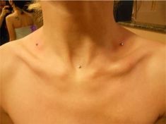 a woman's chest with small bumps on her left side and the bottom part of her neck