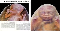 an article in the magazine shows two images of a baby with plastic covering it's head