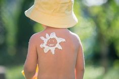 a young child with sunburn on his back