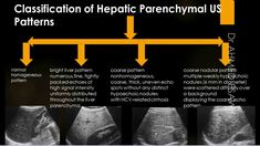 Liver Ultrasound Diffuse Disease Cirrhosis , fibrosis , Scoring , Hepatitis , Autoimmune , Contra - YouTube Hyrox Training, Liver Fibrosis, Body Organs, True Facts, Day Work