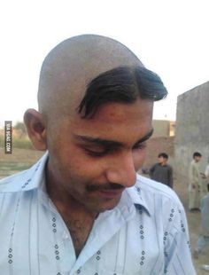 Trim Haircut Men, Long Trim Haircut Men, Manly Haircut, Terrible Haircuts, Ugly Hair, Female Pattern Baldness, Epic Fails Funny