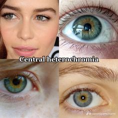 Heterochromia Eyes, Gray Eyes, Aesthetic Eyes, Gorgeous Eyes