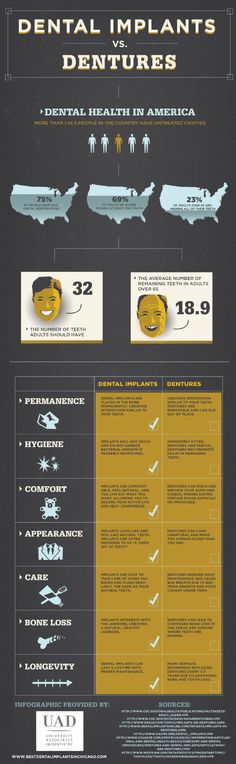 Dental Implants vs Dentures Dr. Tony Martin can also provide implant overdentures that allow for a traditional denture to snap in securely to a few strategically placed implants.  This is a nice option for a patient with many missing teeth who cannot afford a large number of dental implants. Dental Dentures, Facebook Ideas, Dentist Hygienist, Dental Education, Dental Assisting, Dental Tips, Denture Implants