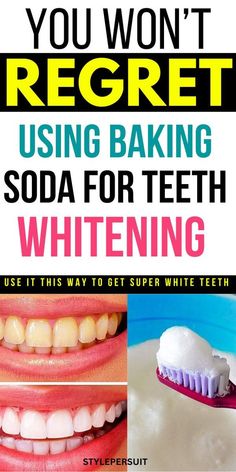 Try this hack for White teeth within 2 minutes | How to Whiten Teeth With Baking Soda 
Watch Free Video Now 

How To Use Baking Soda To Whiten Your Teeth: if you want to explore natural teeth whitening treatments, baking soda is a great option. Read on to know more about the benefits of using baking soda to get pearly white teeth. #teethwhitening #whiteteeth #remedies #homeremedies Baking Soda For Teeth, Pearly White Teeth