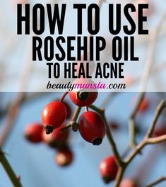 How to Use Rosehip Oil for Acne - beautymunsta - free natural beauty hacks and more! | Diy acne treatment, Natural acne remedies, Rosehip oil #Benefits_Of_Rosehip_Oil #Overnight_Remedies #Home_Remedies_For_Pimples #Rose_Hip_Oil Benefits Of Rosehip Oil, Dhc Cleansing Oil, Overnight Remedies, Rosehip Oil Benefits, Skin Care Routine For 20s, Acne Vulgaris, Natural Acne Remedies, Natural Acne, Acne Oil