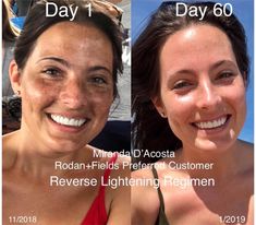 Rodan Fields Lash Boost, Rodan And Fields Reverse, Rodan And Fields Consultant, Skin Care Routine For 20s, Life Changing Skincare, Premium Skincare, Mascara Facial, Skin Discoloration, Sun Damage