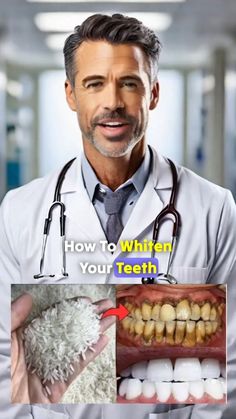 gentle dental care How To Brighten Your Teeth, How To Brighten Teeth Naturally, Baking Soda Teeth, Natural Teeth Whitening Diy, Baking Soda Teeth Whitening, Brighten Teeth, Teeth Whitening Homemade, Teeth Whitening Remedies, Teeth Whitening Diy