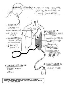 the diagram shows how to use an inflatable device for diapering and breathing