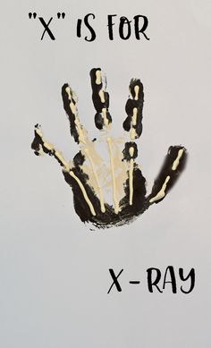 a hand with the words x is for x - ray painted on it