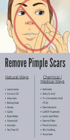 Remove pimple scars Pimple Scar Removal, Tea Tree Oil Skin, To Remove Pimples, Remove Pimples, Pimple Scars, Skin Grafting, Clear Healthy Skin, How To Get Rid Of Pimples, How To Remove Pimples