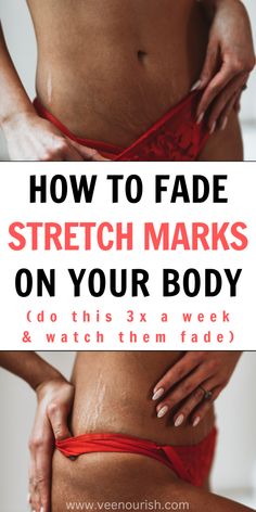 Stretch Marks Remedies | How To Remove Stretch Marks Fast & Naturally Stretch Mark Prevention Pregnancy, Day Skincare Routine, Stretch Mark Prevention, Strech Marks, How To Fade