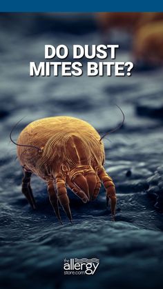 People frequently ask if dust mites bite. They have skin problems associated with their allergies (such as allergic urticaria) and assume that these hives are bites. Dust Mites Bites, Allergy Hives, Skin Allergies, Skin Problems, The Question, Skin