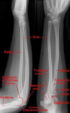 an x - ray shows the different bones and their corresponding parts, including the foot