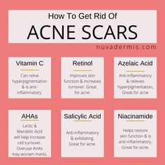 Skincare Products For Acne Marks, How To Help Hyperpigmentation, What Helps With Acne Scarring, How To Reduce Acne Scarring, Acne Scarring Products, Remove Acne Scarring, How To Remove Scars From Acne, Reduce Acne Scarring, How To Treat Acne Scaring