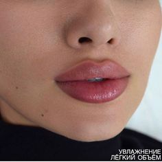 Cheek Fillers, Lip Filler, Botox Fillers