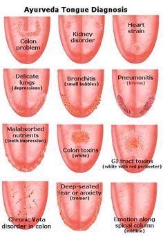 Dans le diagnostique ayurvédique, la connaissance de la PRAKRUTI est très importante. Par exemple, une personne dont la PRAKRUTI est de type VATA aura tendance à avoir des maladies de type VATIKA. En lui les maladies d’autres types ne prennent pas ou sont très faciles à éliminer. Pour prévenir les maladies, la personne VATIKA devra toujours éviter les facteurs et la nourriture, boisson et régimes aggravant VATA. Similairement on doit donner à une PRAKRUTI de type PITTA des médicaments qui rafraî Asthma Attacks, Homeopathy, Health Info, Chinese Medicine, Alternative Medicine, Acupuncture, Health Remedies