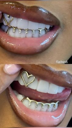 Gold Teeth Grills Aesthetic, Gold Teeth Grills Black Women, Black Women Grillz Aesthetic, Golds On Black Women Teeth, Grills Black Women Aesthetic, Women’s Gold Grill, Wedding Grills Teeth, Black Grills Teeth, Mouth Grill For Women