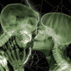 an x - ray image of two people kissing each other