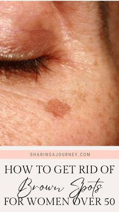 Get Rid Of Age Spots, Age Spots On Face, Brown Age Spots, Age Spot Removal, How To Help Nausea, How To Fade, Brown Spots On Skin, Get Rid Of Wrinkles, Natural Skin Care Ingredients