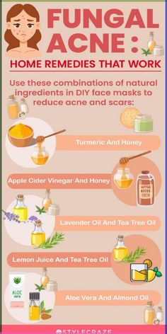 Home Remedy for Treating Fungal Acne. | #Skincaresolutions Back Acne Remedies, Blind Pimple, Fungal Acne, Turmeric And Honey, Acne Overnight, Acne Vulgaris, Diy Acne, Natural Acne Remedies, Natural Acne