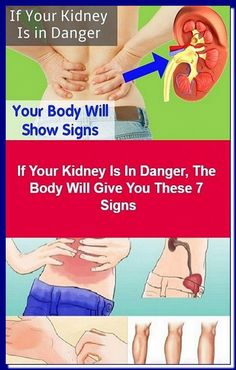 Color Of Urine, Healthy Kidneys, Kidney Health, Healthy Beauty, What Happened To You, The Body, Home Remedies, Healthy Life, Disease