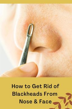 How long does it take for blackheads to go away Skin Glow Tips, Black Heads, Cold Medicine