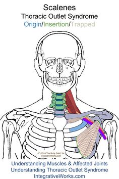 Swollen Hands, Thoracic Outlet, Acupuncture Benefits, Trigger Point Therapy, Hand Massage, Trigger Points, Anatomy And Physiology