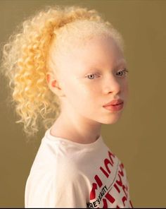 Albino Hairstyles, Albino Girl Black, Albino Black Woman, Albino Black People, Eri Aizawa, Albino Art, Black Albino, Albino People, Albino Model