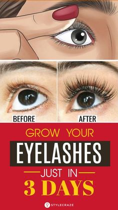 Healthy Lashes, Eyelashes Longer, Make Eyelashes Longer, Gene False, Long Eyelashes