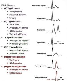 Telemetry Technician, Ekg Technician, Nursing Hacks, Nursing Knowledge, Basic Anatomy And Physiology, Nursing Courses