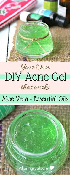 diy acne gel can help you to get rid of hateful acne and pimples. It also lightens dark spots and scars and calms your red, inflamed and painful acne. Check out how does it can help you. Facial Remedies, Joululahjat Diy, Painful Acne, Make Up Diy, Make Up Foundation, Acne Gel, Diy Acne, Diy Kosmetik, Baking Soda Shampoo