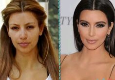 kim karday before and after plastic surgery