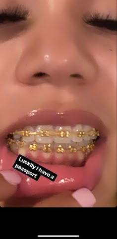 Teeth Gems With Braces, Power Chain Braces Black Women, Powerchain Braces Colors Ideas, Silver Braces Black Women, Pink Power Chain Braces, Black Braces On Black People, Braces Aesthetic Colors, Hot Pink Braces, Brackets Aesthetic